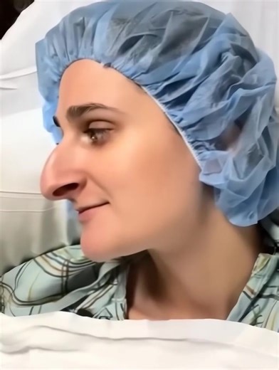“Ha speso 11.000 dollari per correggere una cosa del suo viso.” Dopo aver risparmiato per un decennio, la trasformazione di Devyn ha fatto parlare tutti. 👃 Guarda le sue foto prima e dopo nei commenti 👇 Mostra meno | L'Italia si ribella