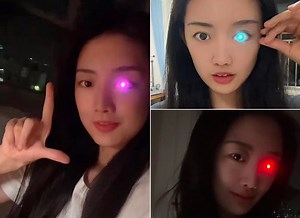 Woman Replaces Eye Lost in Accident with Prosthetic That Lights Up in Different Colors