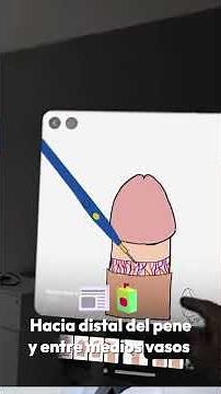 Te explico como se realiza una circuncision