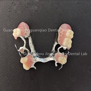 [Hot Item] Digital Dentures Factory Cheap Price Removable Metal Framework with Acrylic Dentures Combine Strength and Comfort Fast Delivery