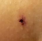 How to Submit a Tick | Connecticut Veterinary Medical Diagnostic Laboratory