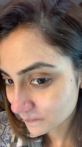 1.9K reactions · 117 shares | How I remove my blackheads and whiteheads  | Zone Perfect | Facebook