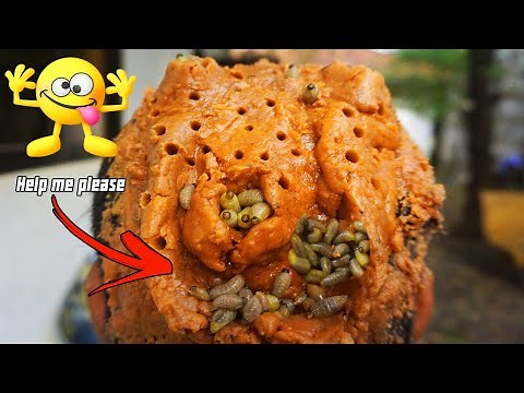 OMG Really Bad Flakes!! So Much Worms On Psoriasis Scalp Were Removed By Dr Giant Flake #447