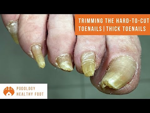 Trimming the thick toenails, the hard to cut toenails of an 85 year old skydiving champion! **asmr**