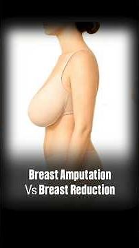 Breast Amputation VS Breast Reduction | Which Is Better for Very Large Breasts?