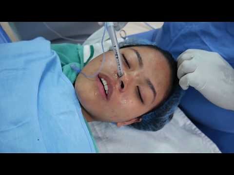 Putting a Girl into Sleep - General Anesthesia - Intubation