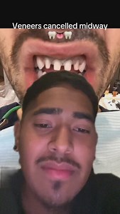 Bro thought he was getting veneers for free 🙏🏾🦷💸 #Veneers #Gap #Teeth #Denied #Insurance #Braces | Adrian Peru