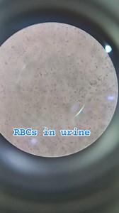 64K views · 1.6K reactions | Urine RE Test. | Wali Rehman Clinical Laboratory | Facebook
