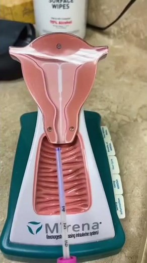 IUD INSERTION 😬😬