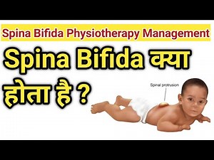 spina bifida & physiotherapy treatment of spina bifida /neural tube defect