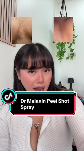 Transform Your Skin with Dr. Melaxin Peel Shot Spray