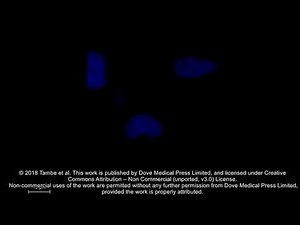 DOX-loaded bare MSNPs internalization in LNCaP cells - [ID 184634]