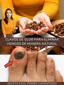 3.7K views · 30 reactions | Remedio para hongo de las uñas, como un borrador! Efectivo contra hongos de uñas 100%.Esta receta te encantará. Para seguir recibiendo mis recetas, solo debes decir algo… ¡Gracias | Hazlo ahora | Facebook
