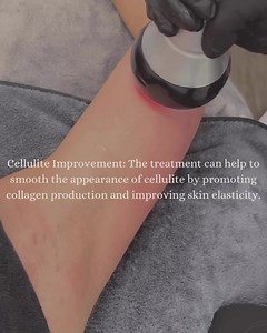 What’s the science behind it? Body Cavitation utilizes ultrasound technology to target and break down fat deposits in the body. By applying focused ultrasound waves, the treatment disrupts the fat cells, causing them to release their contents. Over time, the body naturally processes and eliminates these fat cell remnants. This results in a reduction of fat in the treated area, leading to improved body contouring and a smoother appearance. Body cavitation is often sought after for its ability to 