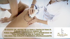 PROCESOS DE CAVITACION ULTRASONICA | Queen Spa Clinic.