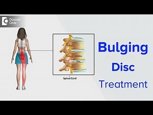 Bulging Disc Treatment - Dr. Kodlady Surendra Shetty