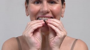 Close-up middle-aged woman putting on transparent aligners on the upper jaw Dental care and dentistr