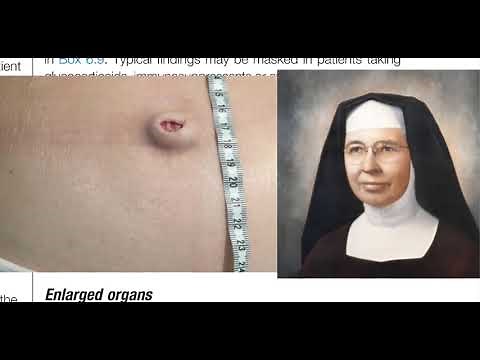 Macleod's GIT Examination: A Deep Dive