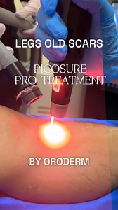 1.2K views | YOUR LEG SCAR PROBLEMS / Dark, unsightly scars on the...