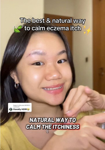 Green Tea Eczema Itch Relief