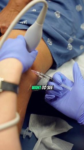 A knee gel injection, also known as viscosupplementation, involves...