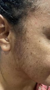 Untidy facial hair problems? Eleganté’s Permanent Hair Removal got you covered. With advance technology, your hairy problems will be gone in just few sessions. Glow up starts here: 𝐏𝐨𝐫𝐭 𝐌𝐨𝐫𝐞𝐬𝐛𝐲 1st Flr., RH Hypermart Gordons, Port Moresby 675 73285010 𝐋𝐚𝐞 𝐂𝐢𝐭𝐲 Warehouse 2, Sec. 27, Lot 53 Butibam Rd., Lae, Morobe Province 675 81571153 | Eleganté Salon and Spa