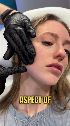 Injection points for the chin