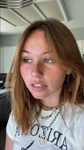 Charming Young Woman Flaunts Freckles and Casual Style#freckles #casualstyle
