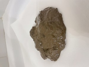 A poop cap before the diarrhea bomb drop!!!