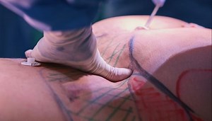 After Jacky Oh's Death, Plastic Surgeon Explains Common Mishaps, The Need To Be Fully Informed