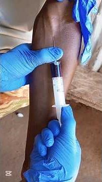 Venipuncture: How to take a venous blood sample