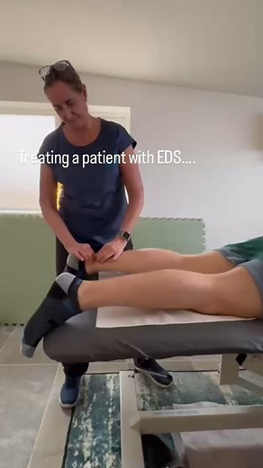 Ehlers-Danlos Syndrome (EDS) is a group of genetic disorders affecting connective tissue, which provides strength and flexibility to the skin, joints, blood vessels, and organs. It is caused by problems with collagen, a key structural protein. Common Symptoms: 1. Joint hypermobility: Flexible joints that can dislocate easily. 2. Skin issues: Stretchy, fragile skin that bruises or scars easily. 3. Other problems: Chronic pain, fatigue, and in severe cases (like vascular EDS), blood vessel or orga