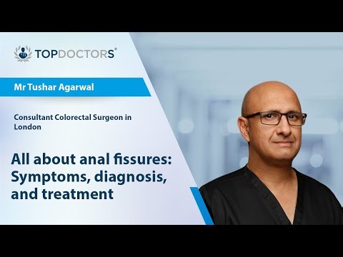 All about anal fissures: Symptoms, diagnosis, and treatment