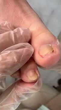 Satisfying Toenail Grooming | Gentle Foot Care Routine #fypシ #cleannails #RelaxingCare #fypシ