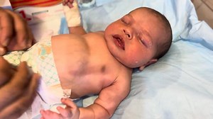 Baby Constipation for 2 Days | Why Your Baby Can’t Poop | Quick Relief Tips for Parents #nicucare #baby #newbornbaby #newborn #neonatologist #babyhealth | Anoop Gautam