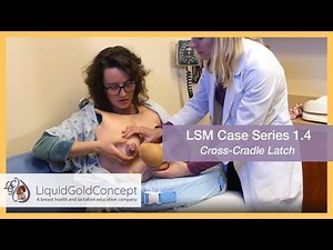 Case 1.4: Cross-Cradle Latch | Lactation Simulation Model Case Series