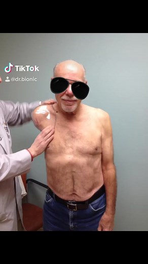 Shoulder Disarticulation Patient Controls Bionic Prosthetic Arm