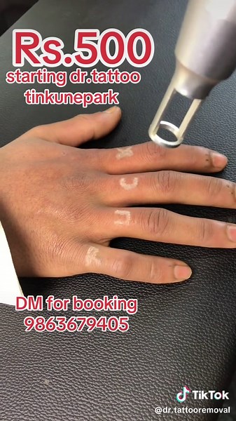 Dr.Tattoo & Removal on TikTok