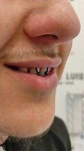 Frenulum piercings—just a trend or an oral health disaster? #DentalTips #StressAndOralHealth #FunnyDentist #OrthoLife | TheBentistofficial
