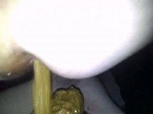 amateur diarrhea on bf's face!!