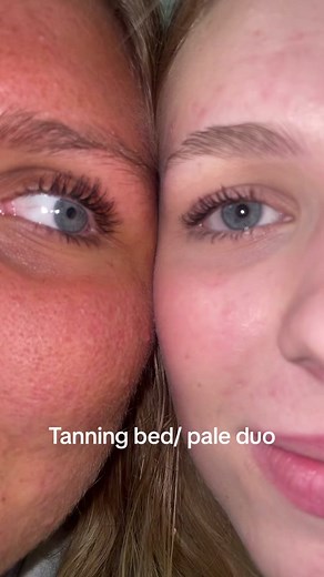 Before and After Tanning Bed Transformation