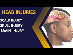 Head Injuries || Scalp | Skull | Brain Injury || Surgery Lecture