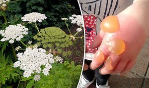 HOGWEED WARNING: Poisonous plant sweeps across UK