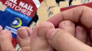 Nail Patches for Toenails, 42PCS Nail Ingrown Toenail Treatment - 8-Hour Overnight Hydrogel Repair for Toenail & Fingernail, Strengthen Brittle Nails, Nail Treatment Patches for Toenail