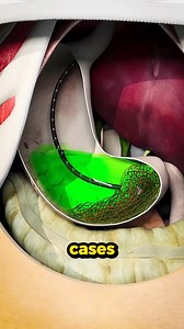 Is it harmful to eat your own hair #facts #randomfacts #learnontiktok #curiosity #satisfying #satisfyingvideos | MindfulFacts | Facebook