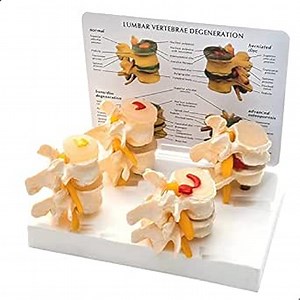 Spancare Corneal Shield Protector 26mm Ophthalmic Eye Shield