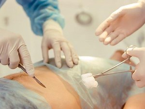 Apandisit nedir, nasıl anlaşılır? Apandisit belirtileri ve tedavisi