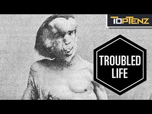 10 Sad Facts About “The Elephant Man” Joseph Merrick