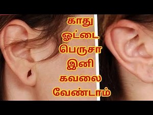 Earlobe Treatment Part1 #vinsbeautycare#earlobetrratment#earlobe#treatment#kadhu#kaduotai#காதுஓட்டை