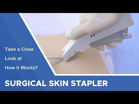 Surgical Skin Stapler: Take a Close Look at How it Works?